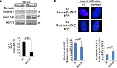 Statins and Histone Deacetylase Inhibitors Affect Lamin A/C – Histone Deacetylase 2 Interaction in Human Cells